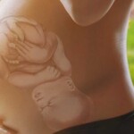 Research Has Found That Probiotics Help Improve Nausea In Pregnancy F